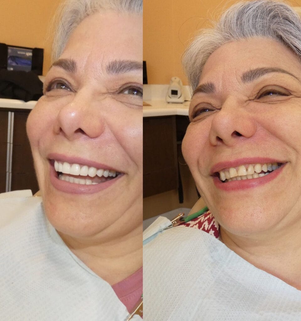 Before and after photos of real dental smile transformations